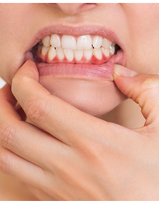 Pulling down lip to show inflamed gums