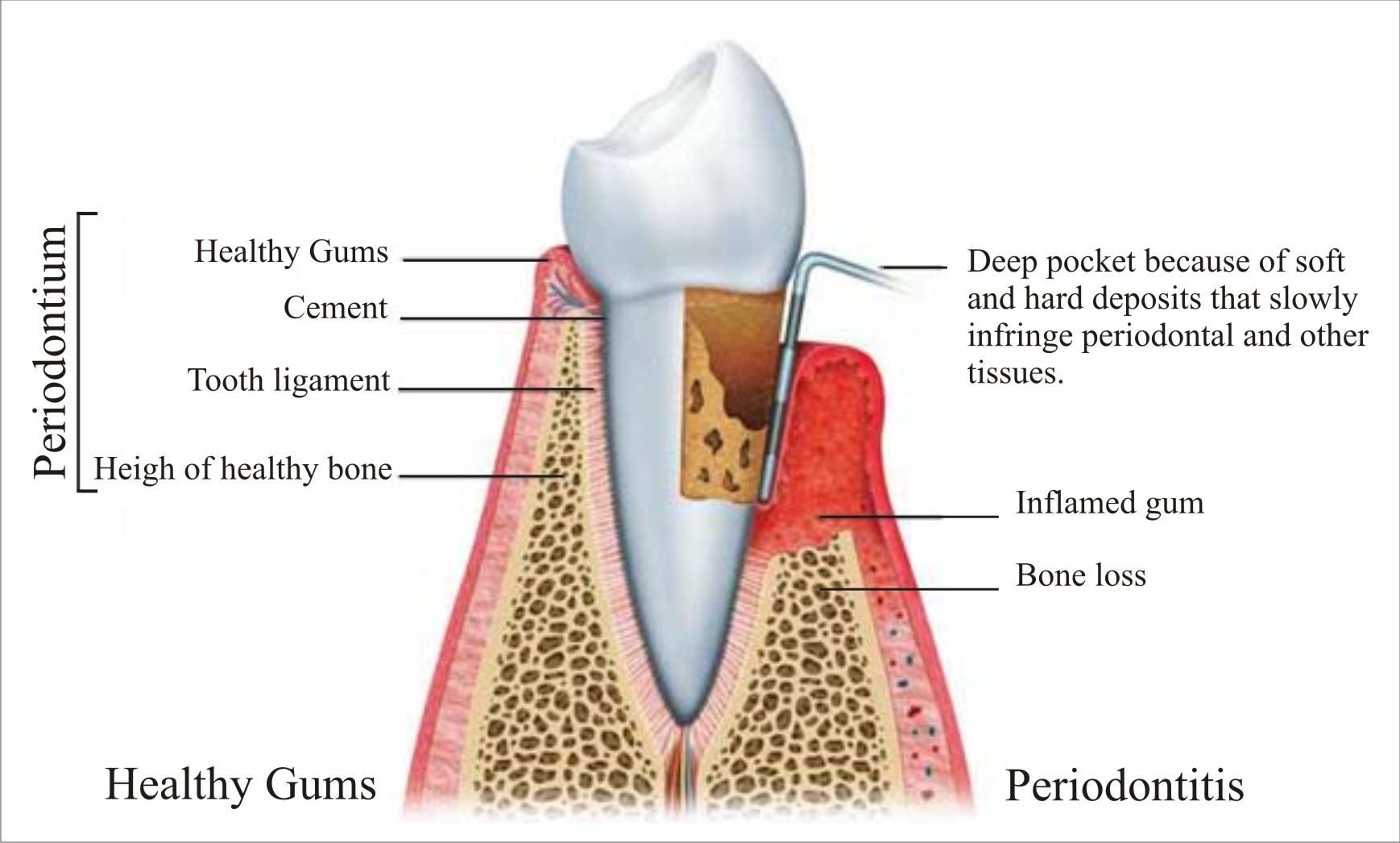 oral health - Spruce Ridge Dental Blog Spruce Ridge Dental Blog